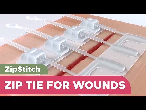 When you can't Stitch it, Zip it: Suture-Less bandage to close wounds