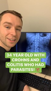 825K views · 7.3K reactions | She had SO MUCH INFLAMMATION, and her doctors never could find what was causing it!  #colitis #ulcerativecolitis #crohns #crohnsdisease #ibs #irritablebowelsyndrome #poop #cantpoop #constipation #diarrhea #gut #guthealing #food #foodallergies #leakygut #wholistic #health #wellness #healing #healingnaturally #autoimmune #autoimmunewarrior #inflammation #antiinflammatorydiet #healthydiet #drhunter | The Wellness Way - Bismarck | Facebook