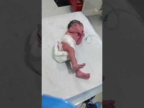 Newborn Baby Critical Condition Assessment | Step-by-Step Emergency Neonatal Examination greauting