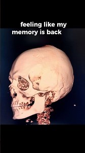 Dysautonomia relief - upper cervical chiropractic