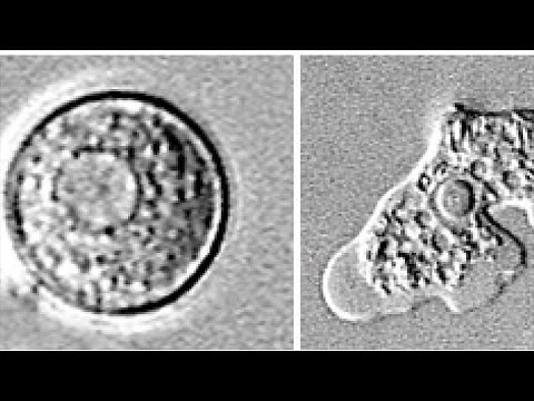 How to stay safe from the brain-eating amoeba