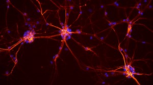 New Study Finds a Single Neuron Is a Surprisingly Complex Little Computer