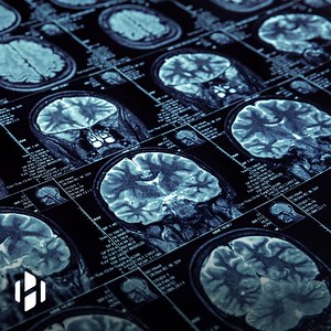 Artificial intelligence can now read peoples’ thoughts. | Hashem Al-Ghaili