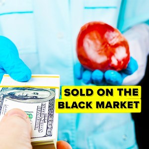 We all know the Black Market is home to some of the most illegal and prohibited items, like firearms, and human organs, but the Black Market is known for selling just about anything, and today we put together a list of the craziest, weirdest most random things you could actually buy on the Black Market. | The Infographics Show