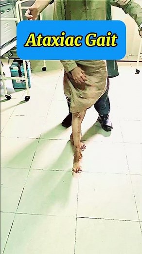 Ataxic Gait | Motor & cerebellar Ataxia | Tendem walk gait examination | Neurology