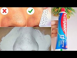 Colgate toothpaste on nose for blackheads | Remove blackheads with colgate | Salt and toothpaste