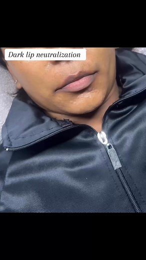 Dark lip neutralization offers numerous benefits, primarily to correct uneven pigmentation and create a brighter, more balanced lip tone. This cosmetic tattooing procedure can significantly boost self-confidence and reduce or eliminate the need for daily lip makeup. Book your appointment today | BellaBrows&Aestheticsclinic