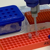 Selective Ribosome Profiling of Co-Translatio - JoVE Journal