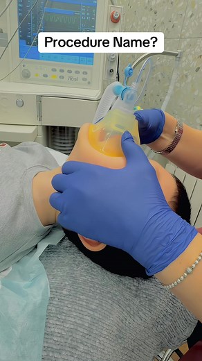 Procedure Name ? #anesthesia #GA #doctor #recoverytok #intubation