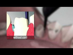 How to Use 3M™ ESPE™ Retraction Capsule