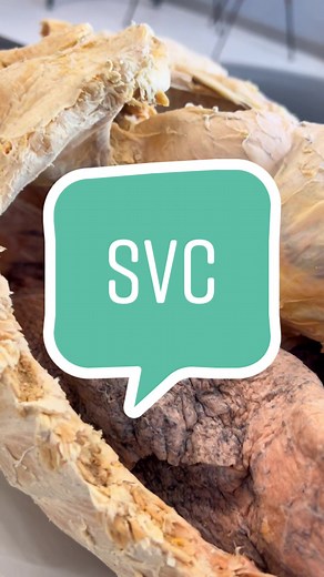 Understanding the Function of the Right Atrium in Blood Circulation