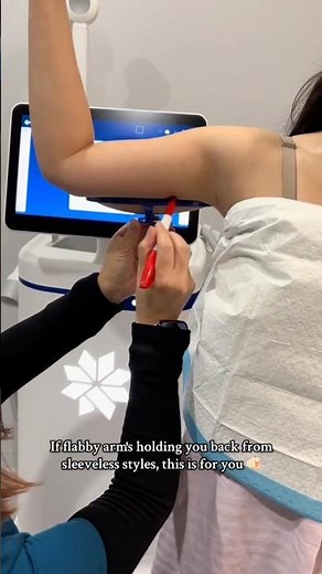 Slimming flabby arms with Coolsculpt treatment