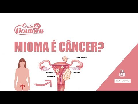 MIOMA UTERINO: Causas, sintomas e tratamentos.