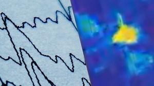 Of Currents and Photons: Should Neuroscientists Use Imaging or Electrophysiology to Monitor Neural Activity?