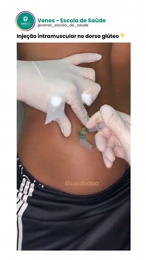 Aplicação Intramuscular no Dorso Glúteo: Técnica e Cuidados