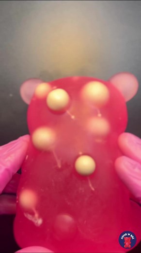 Lets pop some back pimples! #fyp #asmr #relax #satisfying #pimplepop