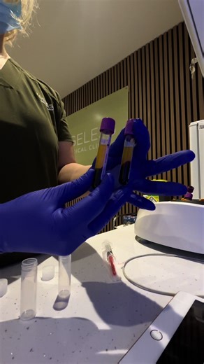 Ever wondered what happens to your blood after it’s taken? 🩸 In this video, Jaiden, our phlebotomist, is placing a blood sample into the centrifuge – the machine that spins the blood at high speed to separate the plasma from the red blood cells. This process allows laboratories to accurately analyse different components of the blood for important health markers. At Ageless Medical Clinic, we offer a wide range of professional blood testing services, helping you gain valuable insights into your 