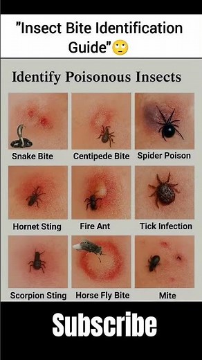Insect bite identification guide for emergency #blum