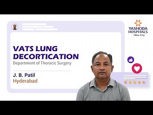 VATS Lung Decortication | Treatment for Multiloculated Pleural Effusion |