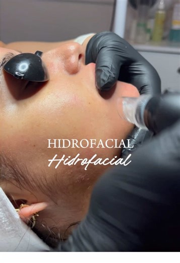Revitaliza tu piel con Hidrofacial en Body Lab