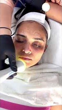 Hydrafacial benefits & side effects