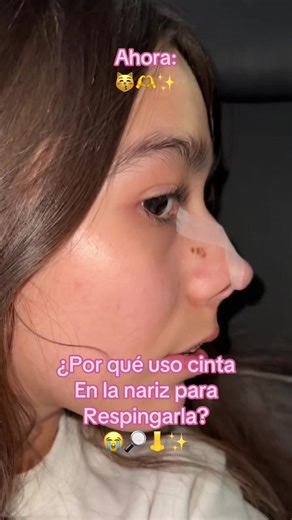 Uso de cinta en la nariz: ¿Por qué lo hago?