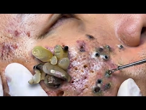 Soothing facial treatment for stress relief at luxury spa achieve inner peace