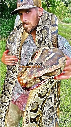 17ft Python Sent Him to the ER 🐍