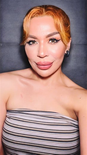 Zabrina | Makeup + Trends on Instagram: "I know this is the most unusual thing you’d see me post on my instagram feed. But it is still related to beauty and about overcoming insecurities and making a person feel more confident. That’s why I thought of sharing my experience with you and my community of bad ass babes! I’ve always been a big supporter of beauty enhancements, cosmetic surgeries or aesthetic procedures. Well if you got the funds for it and it makes you feel more confident and empower