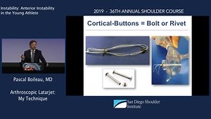 Arthroscopic Latarjet: My Technique