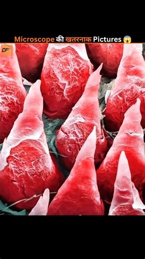 These Normal Things Look Terrifying Under a Microscope 😱
