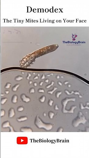 Demodex. The Tiny Mites Living on Your Face #shorts #demodex #health #skincare #youtubeshorts