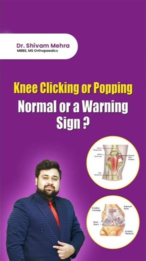 Knee Clicking: Normal or Warning Sign? #KneePoppingIssues Knee Clicking Causes