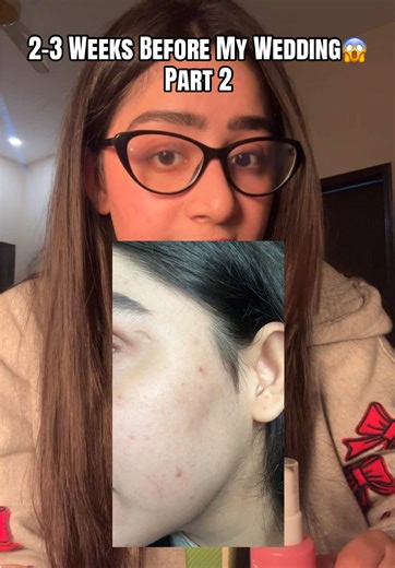 Preparing My Skin for the Wedding: 2 Weeks Countdown