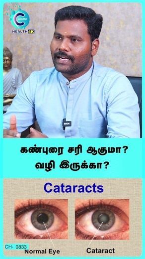Eye Home Remedies Tamil | Dr. Thirugnanam #shorts #shortvideo #eyehealth