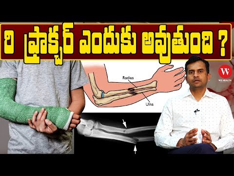 రి ఫ్రాక్చర్ ఎందుకు అవుతుంది? Bone Fractures Types & Treatment | Dr Sharath Babu Orthopedic Surgeon