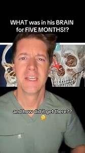Follow for more mind blowing medical cases 😱 #medicalmystery #medschool #nursingschool #physician #nursing #nursepractitioner #physicianassistant #greenscreen | J Mack Slaughter Jr