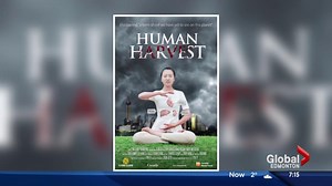 Shocking look at organ harvesting trade in China