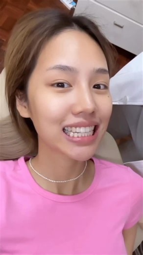 โปรโมชั่นล่าสุด!!! โปรโมชั่นในตำนาน จัดฟัน Invisalign 48,000 บาท กลับมาแล้วตามคำเรียกร้อง!!! เพื่อร่วมฉลองครบรอบ 8 ปี SmileMaker Dental House โดย ผู้ช่วยศาสตราจารย์ ดร. ไอริน ศิริสุนทร ผู้ก่อตั้ง และ ผู้บริหาร SmileMaker Dental House คุณหมอไอริน จบการศึกษาระดับปริญญาเอก สาขาทันตกรรมจัดฟัน จาก มหาวิทยาลัยนางาซากิ ประเทศญี่ปุ่น (Nagasaki University, Japan) 🇯🇵 Clinical/Research Fellow ทางด้านการจัดฟันสำหรับผู้มีความผิดปกติของศีรษะ ใบหน้า และ ขากรรไกร จาก มหาวิทยาลัยเยล ประเทศสหรัฐอเมริกา (Yale Un