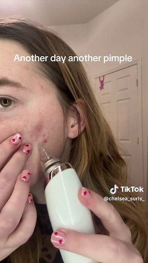 Effective Blackhead Extraction Techniques