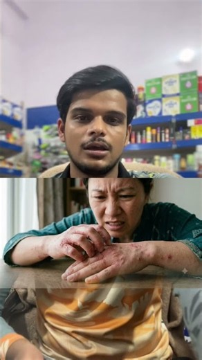 BETNOVATE CREAM SIDE EFFECTS 😱 | Stop Ruining Your Face! Betnovate Cream Kharab Chehre Ko Sahi Kais