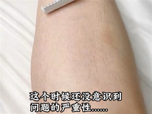 毛毛女变水煮蛋了