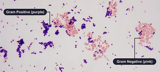 Gram stain procedure: gram staining steps and results in microbiology