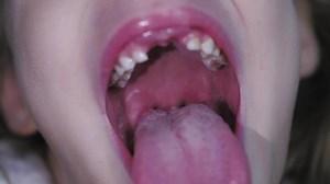 girl opens her mouth wide and pulls out long tongue. child shows his teeth soft palate and mouth to dentist. mouth is wide open, tongue is stuck out as far as possible, with clear view of tongue