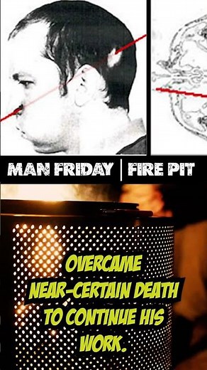 The Man Hit by a Proton Beam