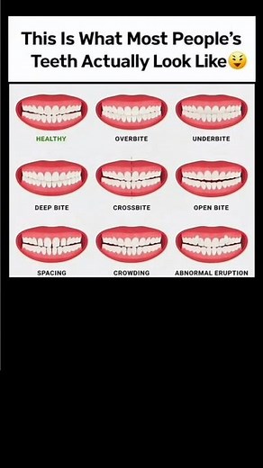 Common Teeth Problems You Might Not Notice