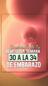 Bebé de 30 a 34 semanas de embarazo 👩‍🦲 #embarazo #15weekspregnant #8weekspregnant #pregnancy | Dr Carlos Uribe Monarrez