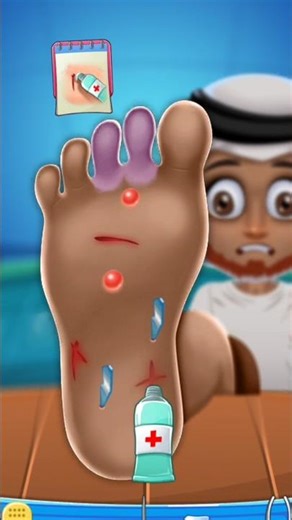 Foot surgery 3d 🦶🦶 #cartoongames #3dgames
