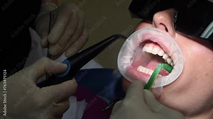 Young female patient receives a dental cleaning from a dentist. The dentist carefully brushes and cleans the womans teeth