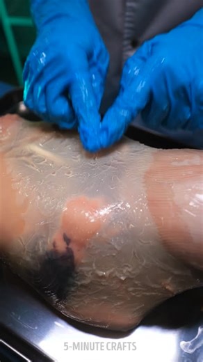 120K views · 156 reactions | Understanding Medical Procedures in a Clear Way | Transformazing | Facebook